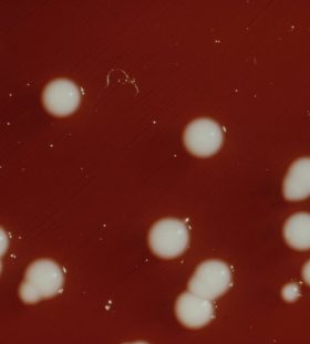 Klebsiella pneumoniae