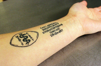 Tattoo Artist Finds Market For Medicalert Tattoos